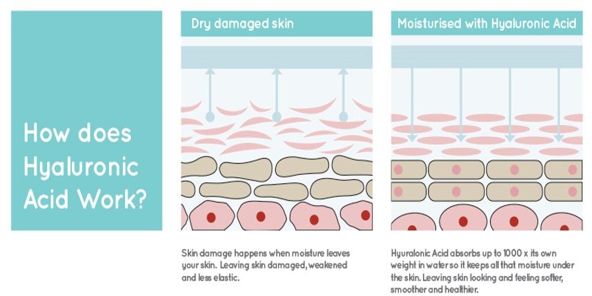 Yếu tố dưỡng ẩm axit hyaluronic